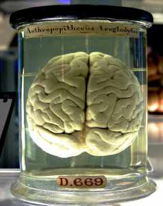 Does Travel Affect the Brain? 2 A Brain, not Travelling